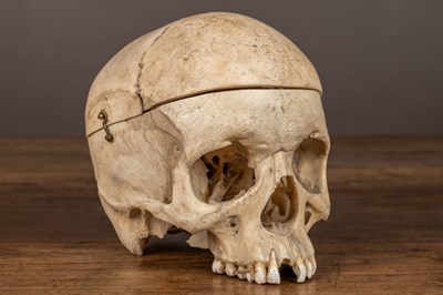 Lot 165 - An anatomical human skull
