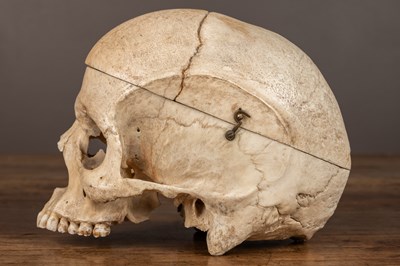 Lot 165 - An anatomical human skull