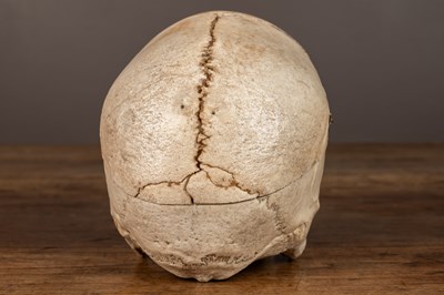 Lot 165 - An anatomical human skull
