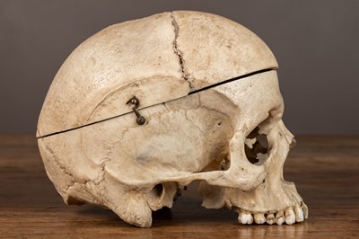 Lot 165 - An anatomical human skull